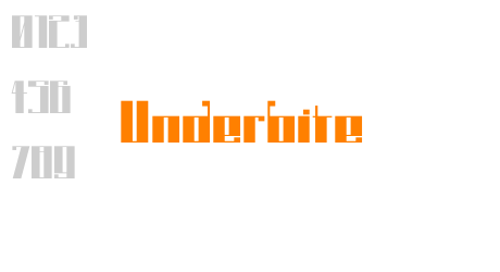 Underbite